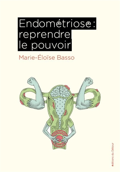 Endométriose : reprendre le pouvoir | Basso, Marie-Eloïse